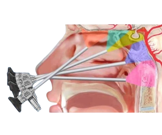 Set endoscópico transnasal Cappabianca Karl Storz