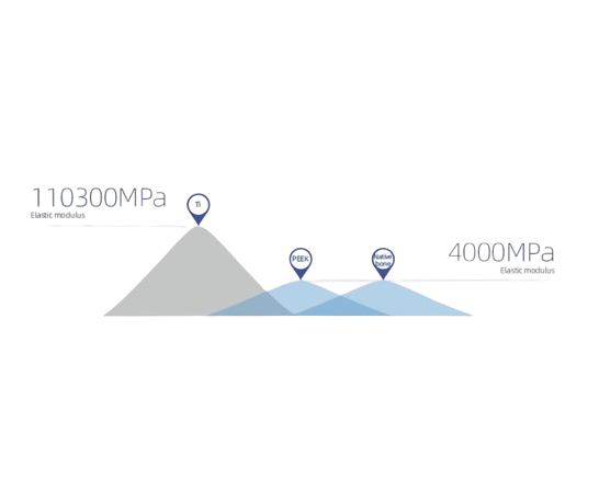 Implante craneal personalizado de Peek Medprin - Image 3